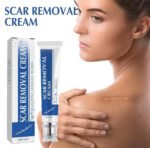 Generic Plastic Scar Removal Cream (White-Blue) - Image 3