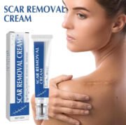 Generic Plastic Scar Removal Cream (White-Blue) - Image 3