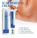 Generic Plastic Scar Removal Cream (White-Blue) - Image 4
