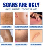 Generic Plastic Scar Removal Cream (White-Blue) - Image 5