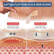 Generic Silicone Scar Tape (Beige) - Image 3